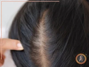 نکاتی برای حجم دادن به ریشه مو